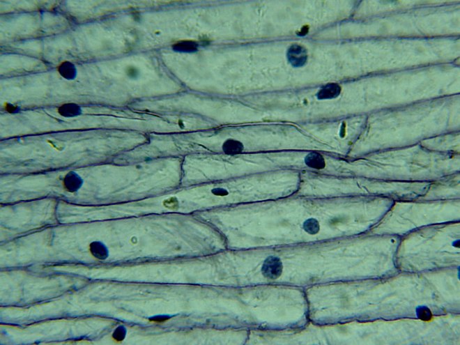 Microscope-LCD-Epidermis-Onion-1